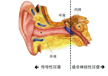 了解孩子的聽力